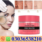 Advanced Freckle Cream In Pakistan